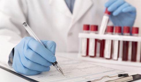 Why is drug testing important in the workplace