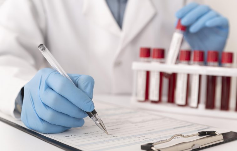 Why is drug testing important in the workplace