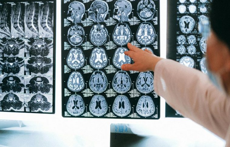 Effects of Brain Injuries