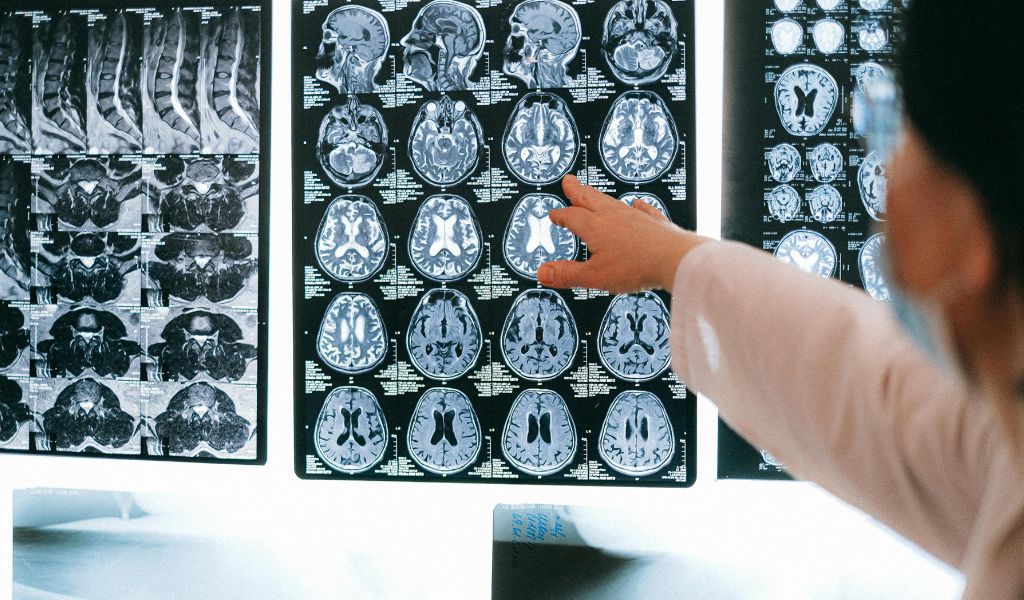 Effects of Brain Injuries