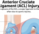 ACL Tear Injury